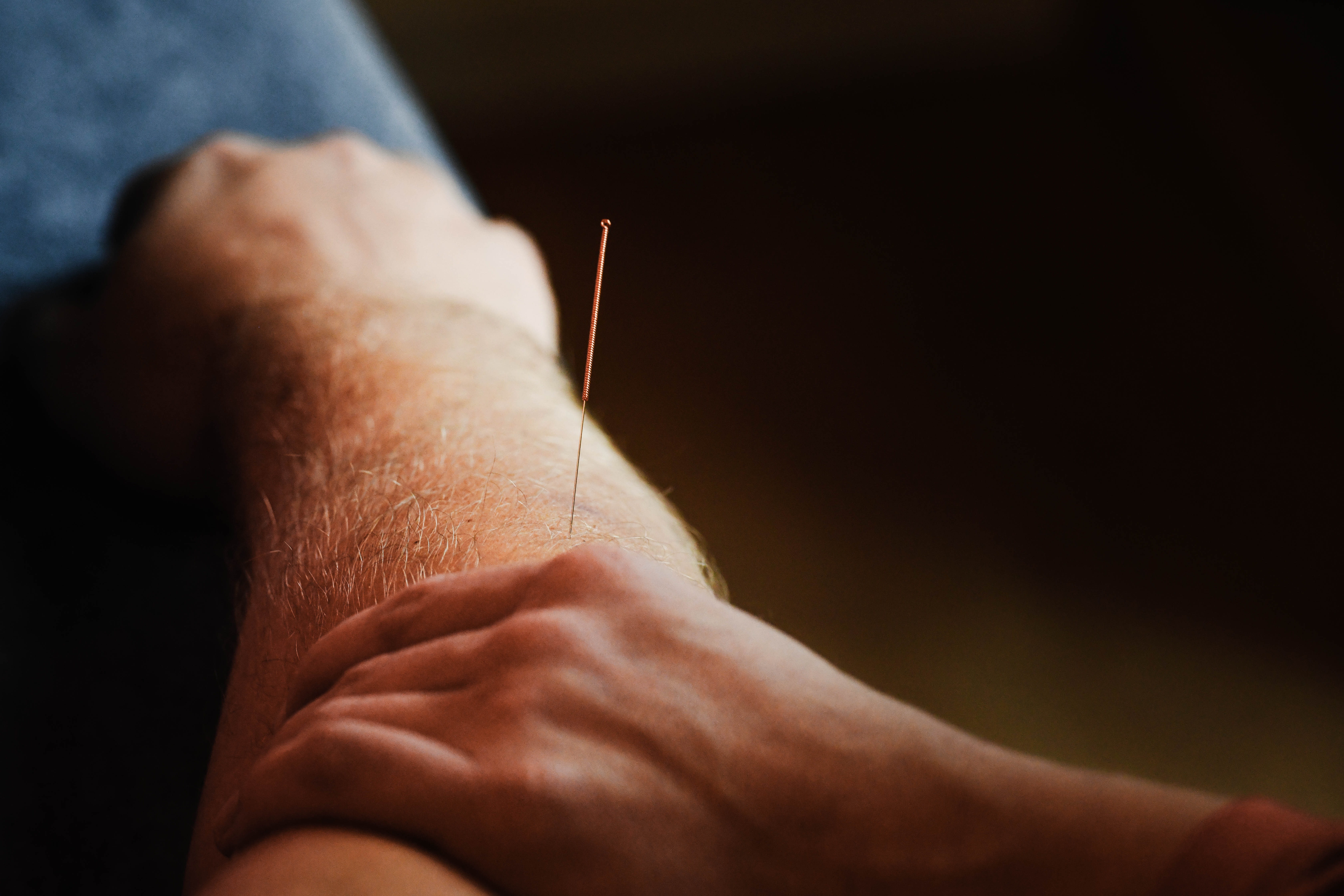 Foto passend bij Dry needling